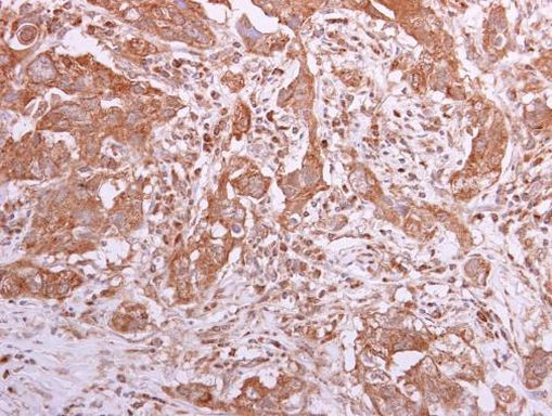 TCP-1 theta Antibody in Immunohistochemistry (Paraffin) (IHC (P))