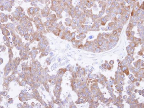 TCP-1 theta Antibody in Immunohistochemistry (Paraffin) (IHC (P))