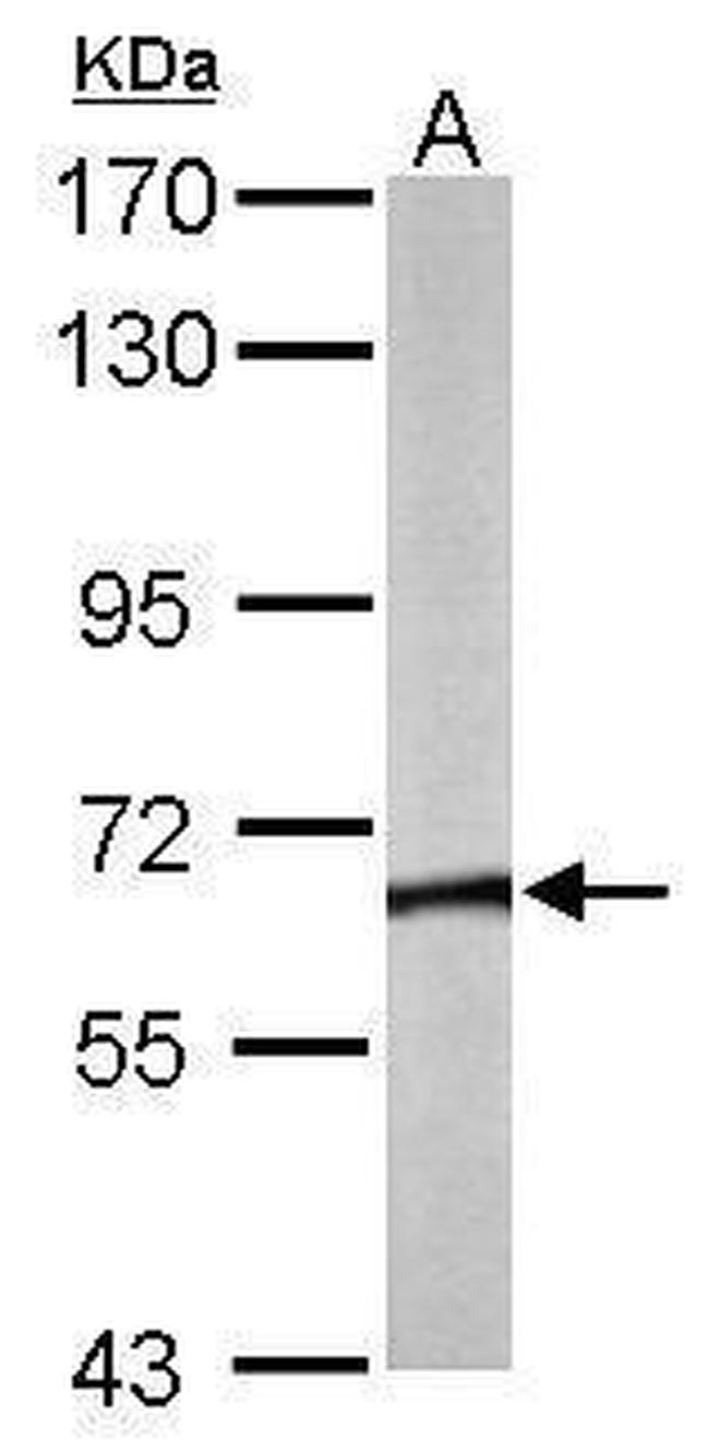 TCP-1 theta Antibody in Western Blot (WB)