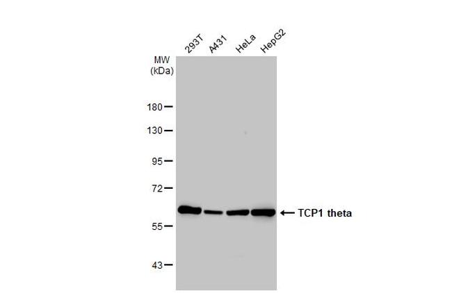 TCP-1 theta Antibody in Western Blot (WB)