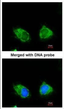 INPP1 Antibody in Immunocytochemistry (ICC/IF)