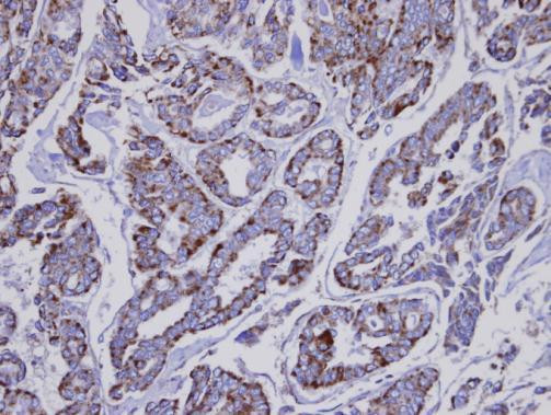 INPP1 Antibody in Immunohistochemistry (Paraffin) (IHC (P))