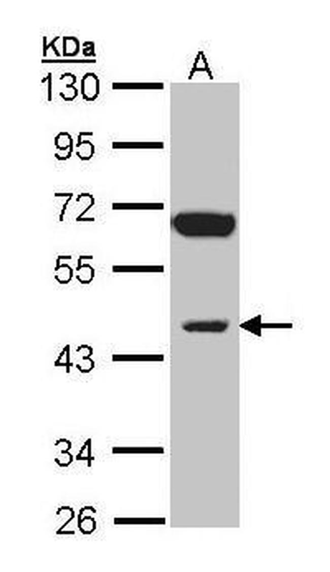 INPP1 Antibody in Western Blot (WB)