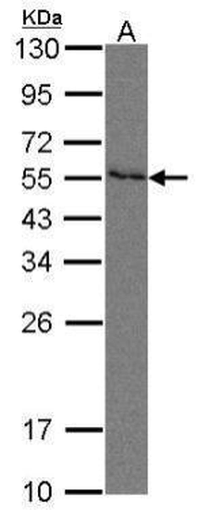 Nectin 2 Antibody in Western Blot (WB)
