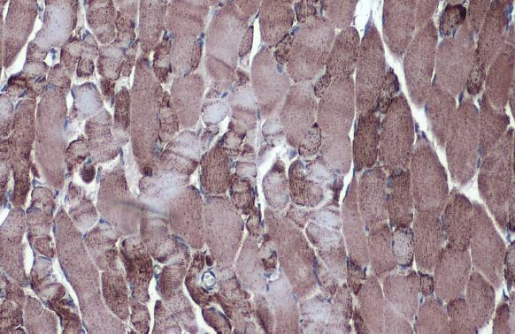 MDH2 Antibody in Immunohistochemistry (Paraffin) (IHC (P))