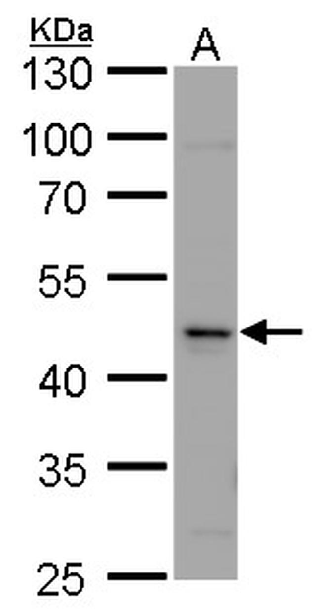 Calsequestrin 2 Antibody in Western Blot (WB)