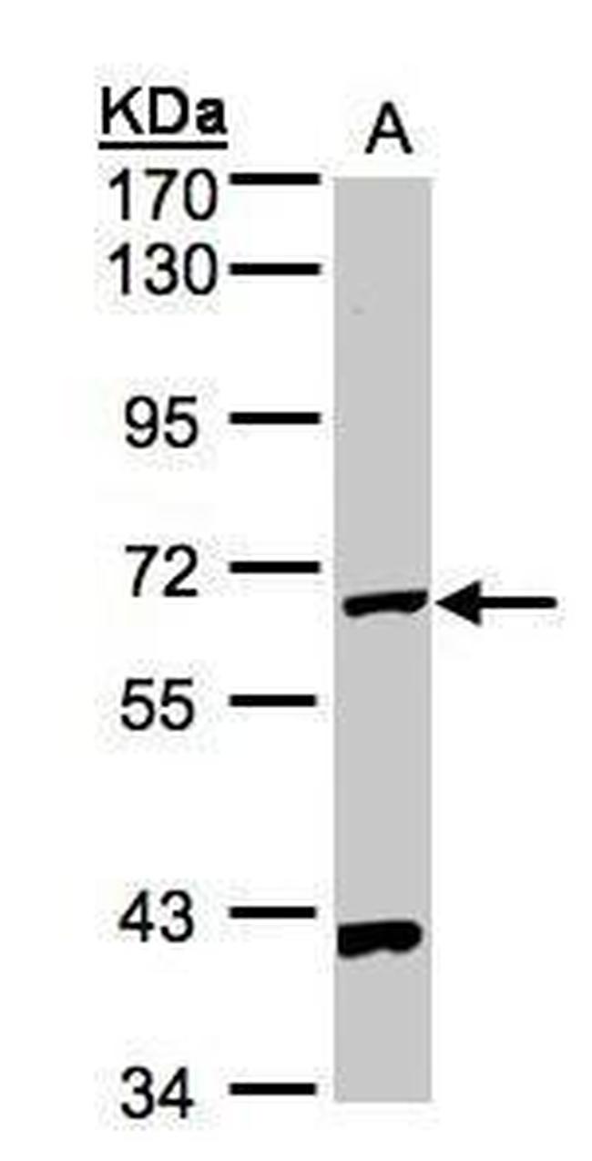 PANK1 Antibody in Western Blot (WB)