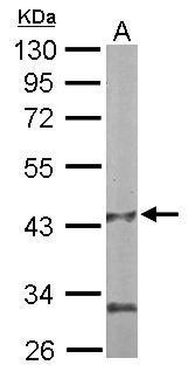 PANK1 Antibody in Western Blot (WB)