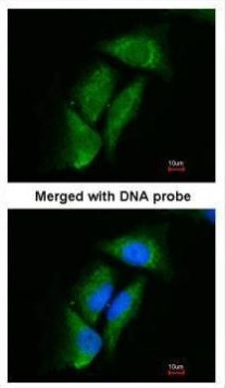 DPP3 Antibody in Immunocytochemistry (ICC/IF)