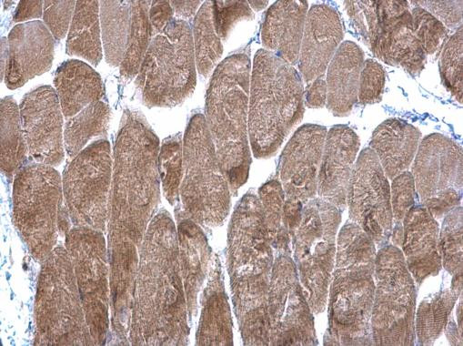 DPP3 Antibody in Immunohistochemistry (Paraffin) (IHC (P))