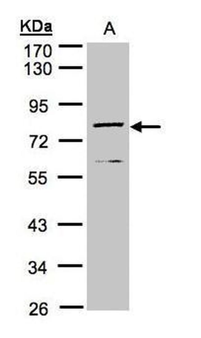 DPP3 Antibody in Western Blot (WB)