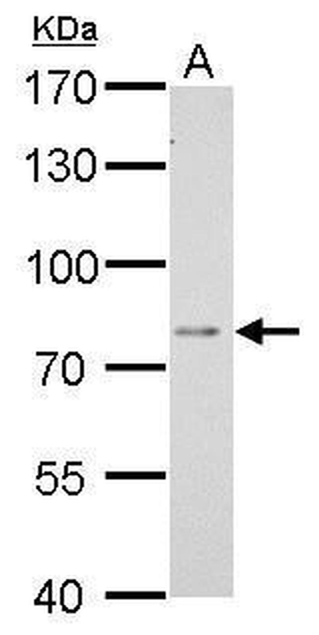 DPP3 Antibody in Western Blot (WB)