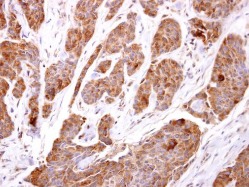 TBCC Antibody in Immunohistochemistry (Paraffin) (IHC (P))