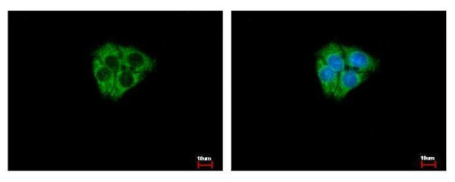 DCAMKL2 Antibody in Immunocytochemistry (ICC/IF)