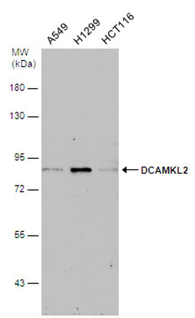 DCAMKL2 Antibody in Western Blot (WB)