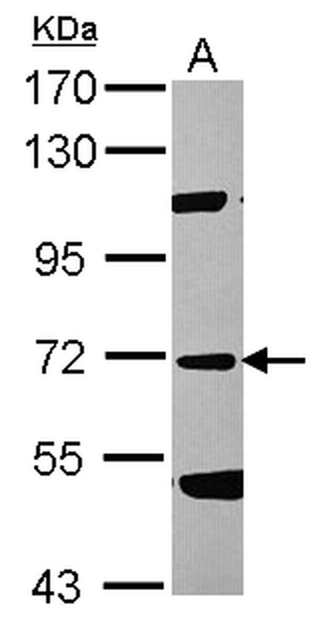 Factor XI Antibody in Western Blot (WB)