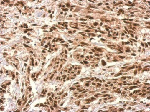 UTP6 Antibody in Immunohistochemistry (Paraffin) (IHC (P))