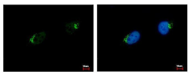 GALNT7 Antibody in Immunocytochemistry (ICC/IF)