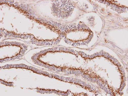 GALNT7 Antibody in Immunohistochemistry (Paraffin) (IHC (P))