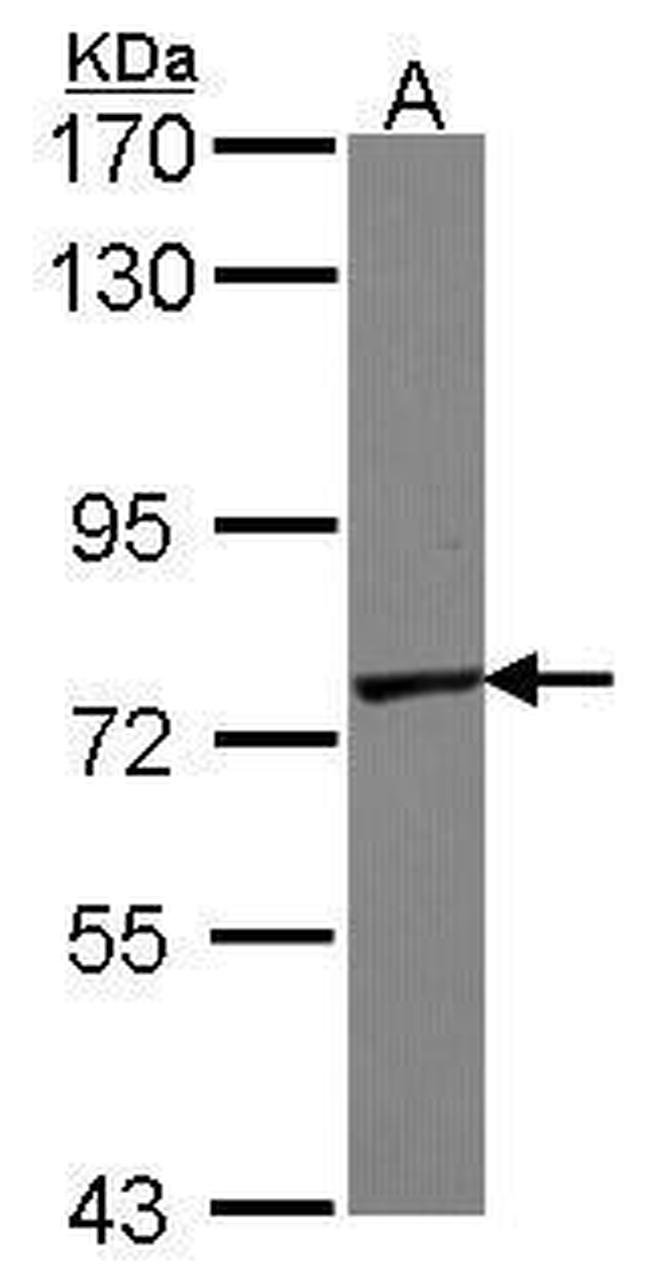 GALNT7 Antibody in Western Blot (WB)