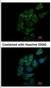 ST3GAL1 Antibody in Immunocytochemistry (ICC/IF)