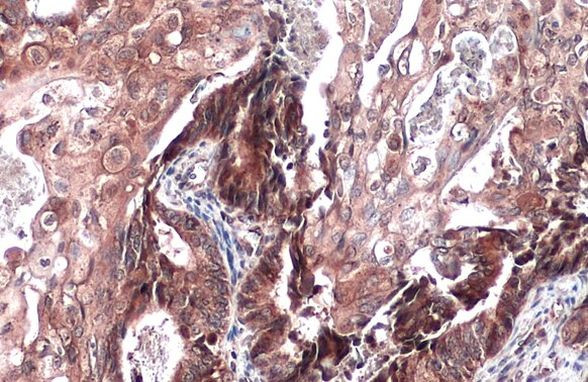 ST3GAL1 Antibody in Immunohistochemistry (Paraffin) (IHC (P))