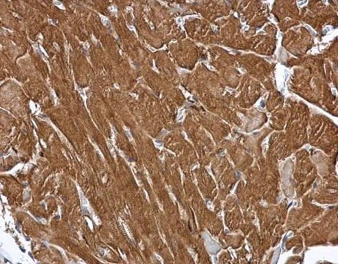 MINPP1 Antibody in Immunohistochemistry (Paraffin) (IHC (P))