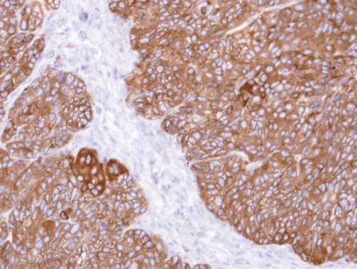 MINPP1 Antibody in Immunohistochemistry (Paraffin) (IHC (P))