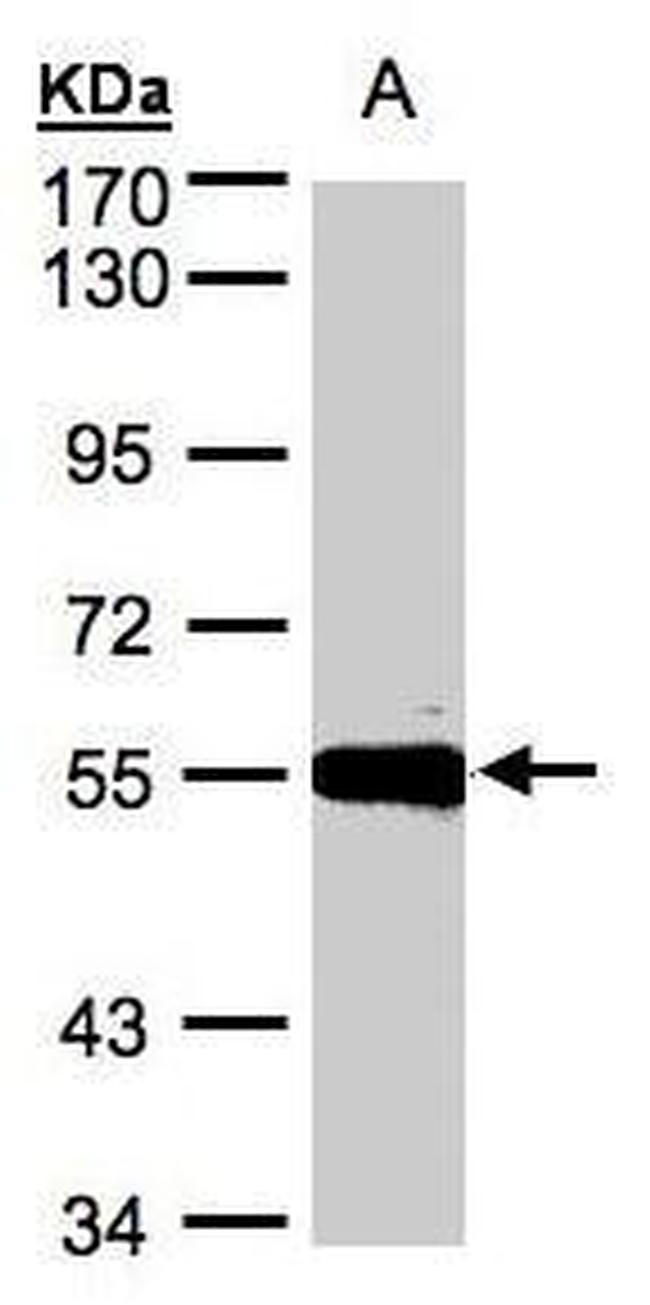 Carboxypeptidase M Antibody in Western Blot (WB)