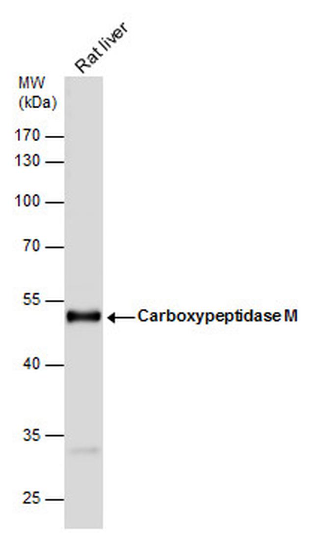 Carboxypeptidase M Antibody in Western Blot (WB)