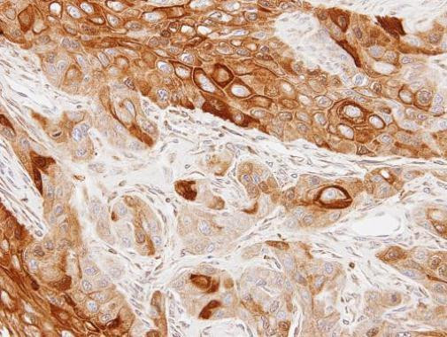 GAS2L1 Antibody in Immunohistochemistry (Paraffin) (IHC (P))