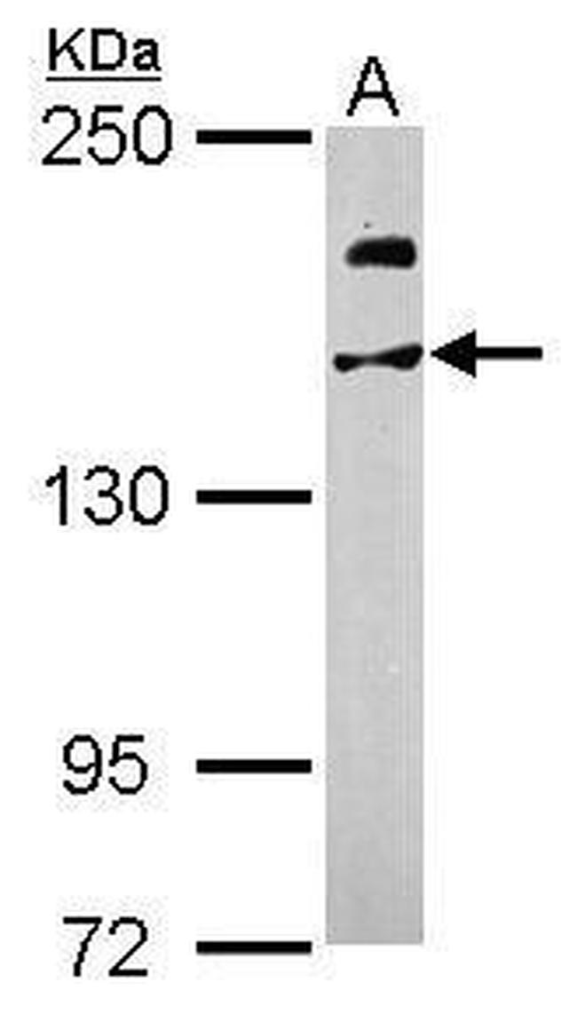 USP47 Antibody in Western Blot (WB)