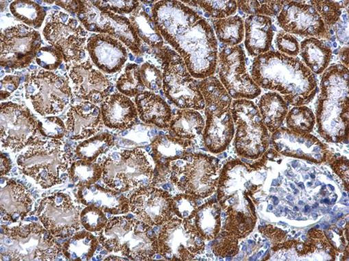 TST Antibody in Immunohistochemistry (Paraffin) (IHC (P))