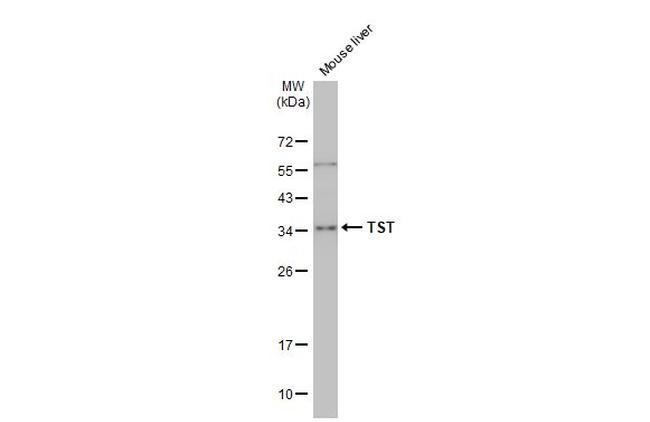 TST Antibody in Western Blot (WB)