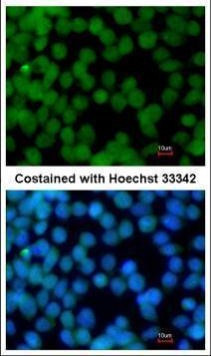 FLII Antibody in Immunocytochemistry (ICC/IF)