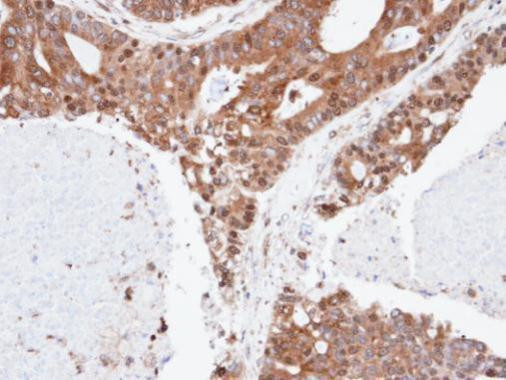 ERLIN2 Antibody in Immunohistochemistry (Paraffin) (IHC (P))