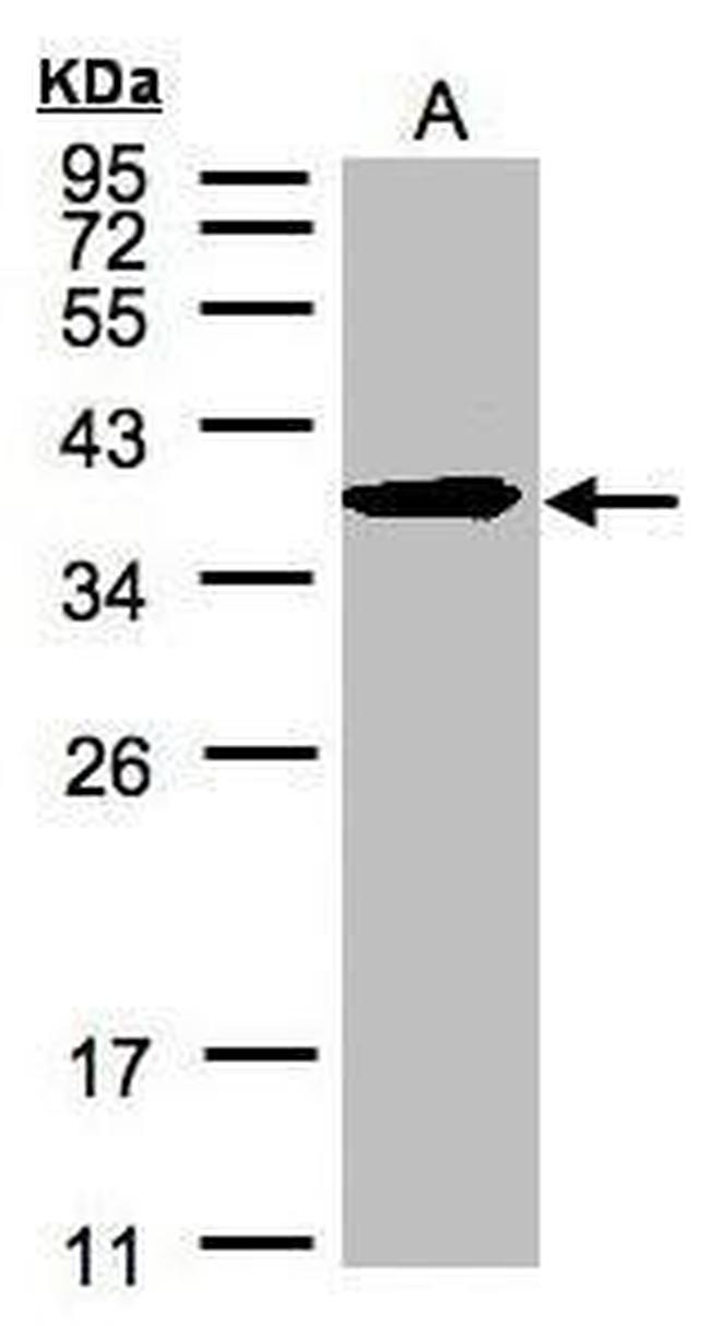 ERLIN2 Antibody in Western Blot (WB)