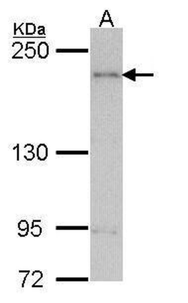 ARAP1 Antibody in Western Blot (WB)