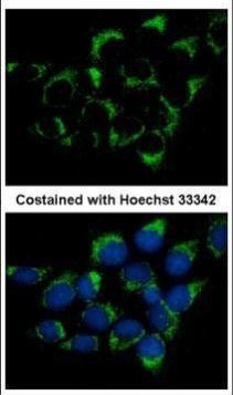 CMG1 Antibody in Immunocytochemistry (ICC/IF)