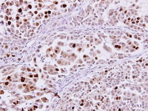 KPNA2 Antibody in Immunohistochemistry (Paraffin) (IHC (P))