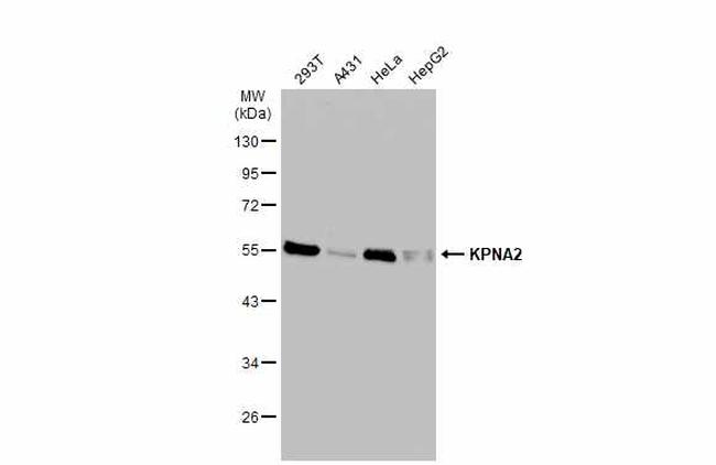 KPNA2 Antibody in Western Blot (WB)