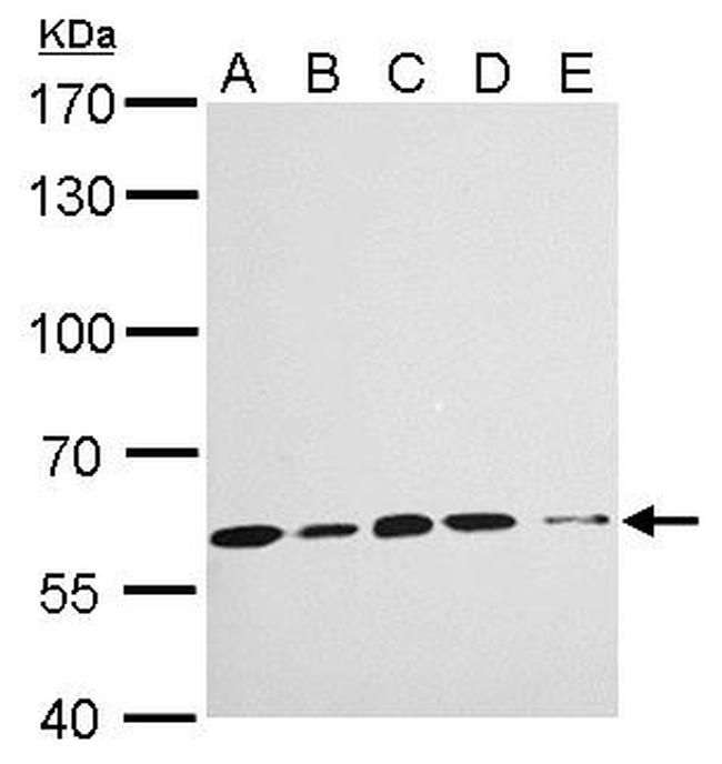 KPNA4 Antibody in Western Blot (WB)