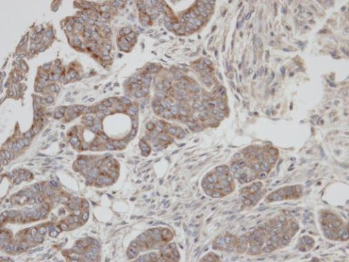 RAB2A Antibody in Immunohistochemistry (Paraffin) (IHC (P))