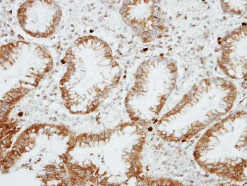 RGS14 Antibody in Immunohistochemistry (Paraffin) (IHC (P))