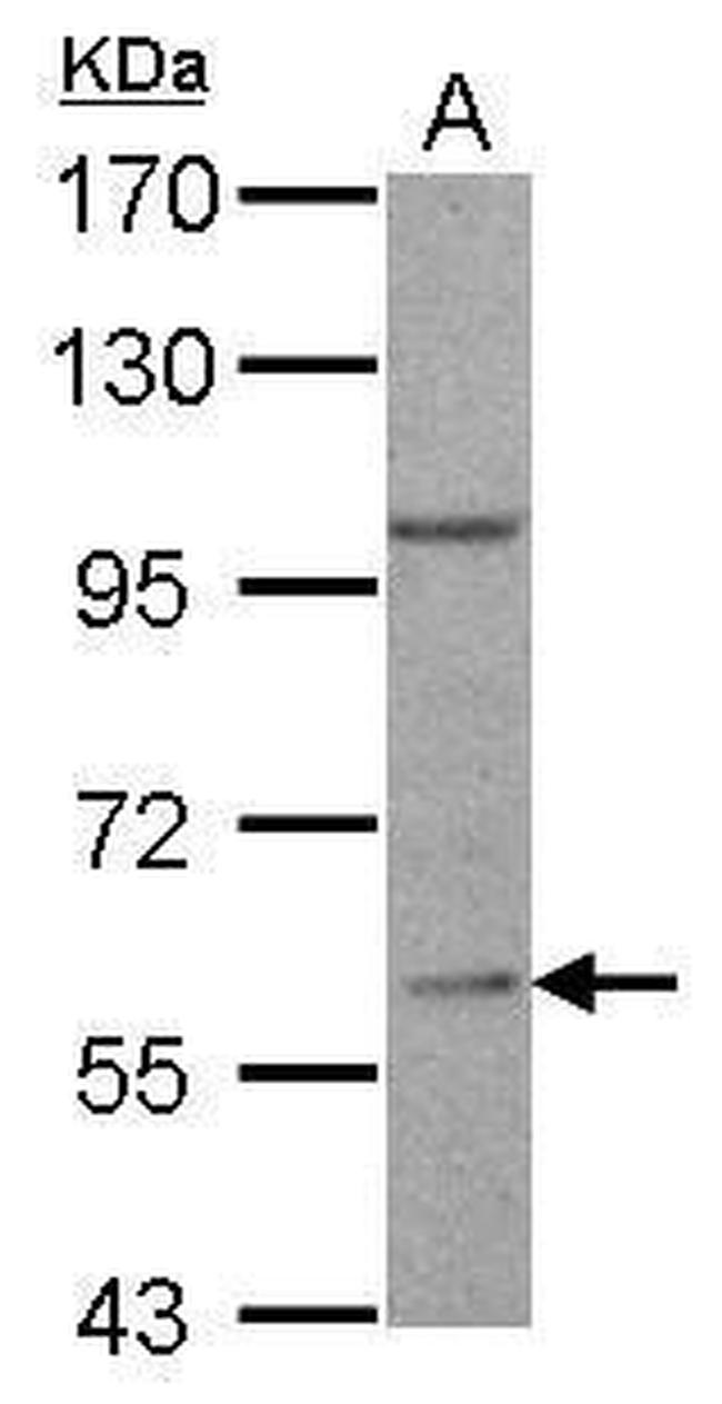 RGS14 Antibody in Western Blot (WB)