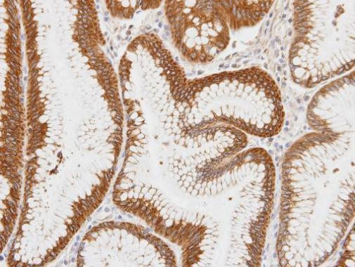 Centaurin alpha-1 Antibody in Immunohistochemistry (Paraffin) (IHC (P))