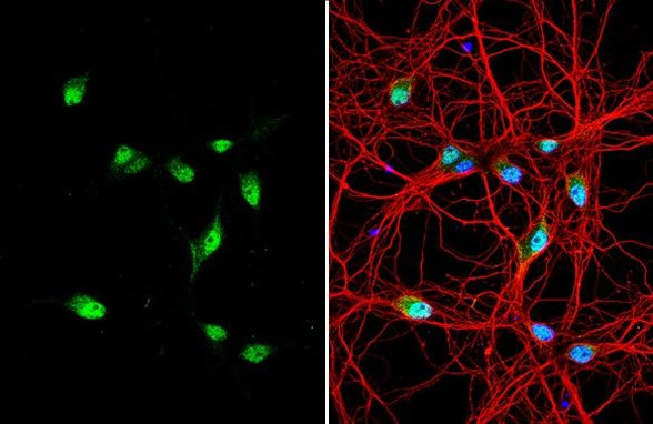 Centaurin alpha-1 Antibody in Immunocytochemistry (ICC/IF)