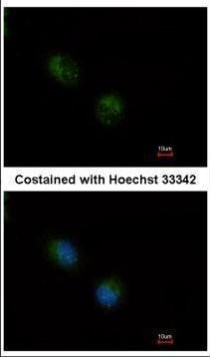 STMN2 Antibody in Immunocytochemistry (ICC/IF)