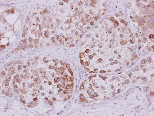 STMN2 Antibody in Immunohistochemistry (Paraffin) (IHC (P))