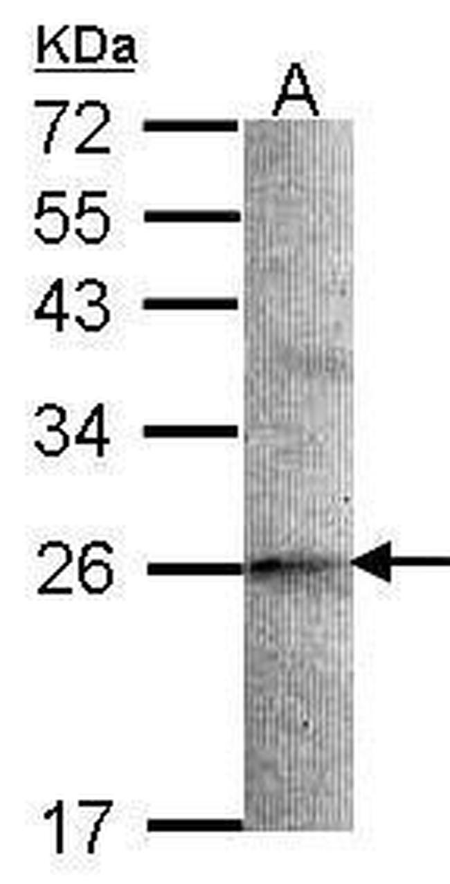 STMN2 Antibody in Western Blot (WB)